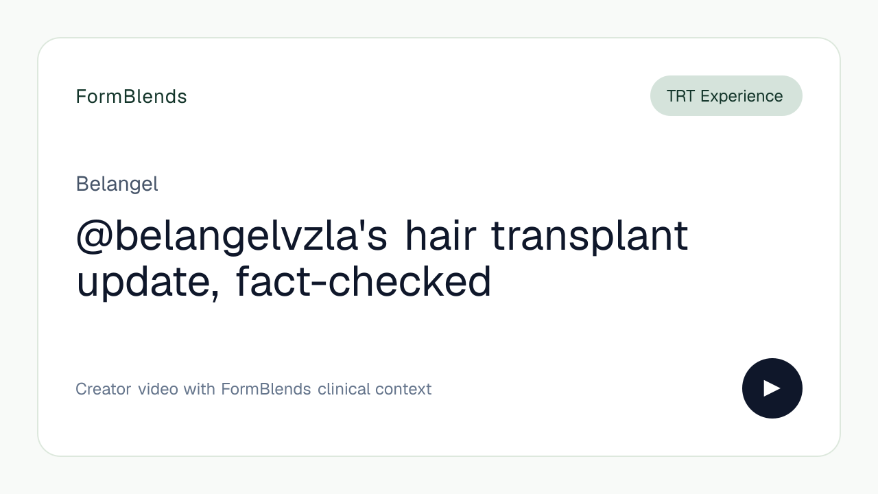 @belangelvzla's hair transplant update, fact-checked