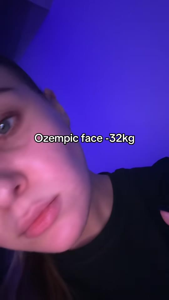 GLP-1 weight loss results: what TikTok skips over