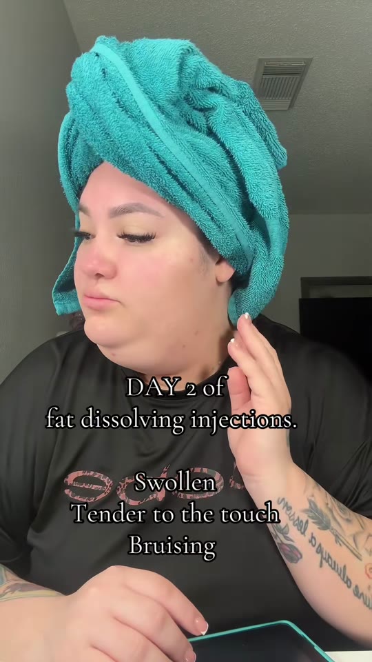 @jasmineluchis's fat dissolving injection claims, fact-checked