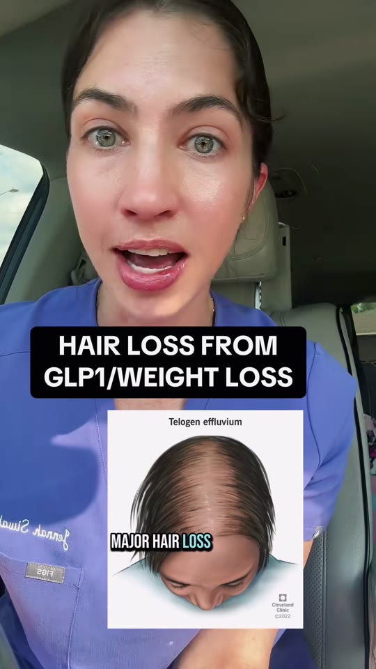 GLP-1 hair loss remedies: what the evidence actually supports