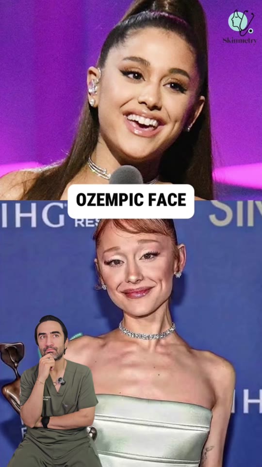 Does Ozempic really cause 'Ozempic face'? We checked