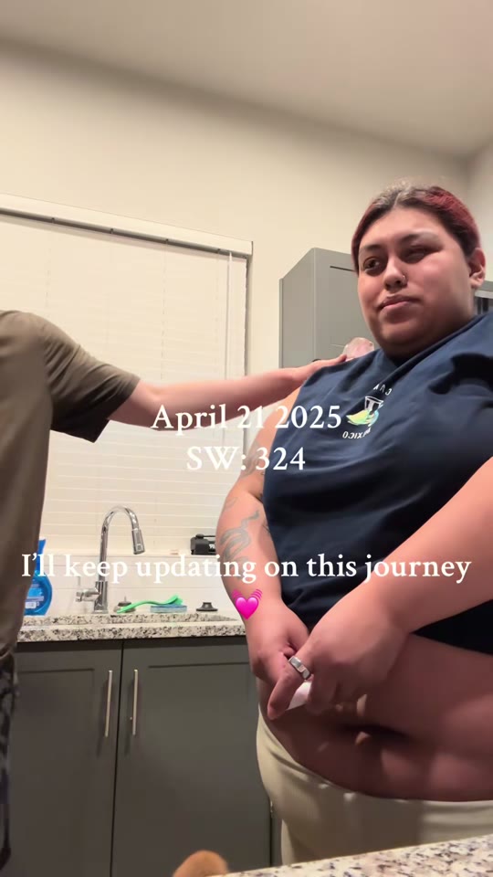 Zepbound injection anxiety: what TikTok gets right and wrong