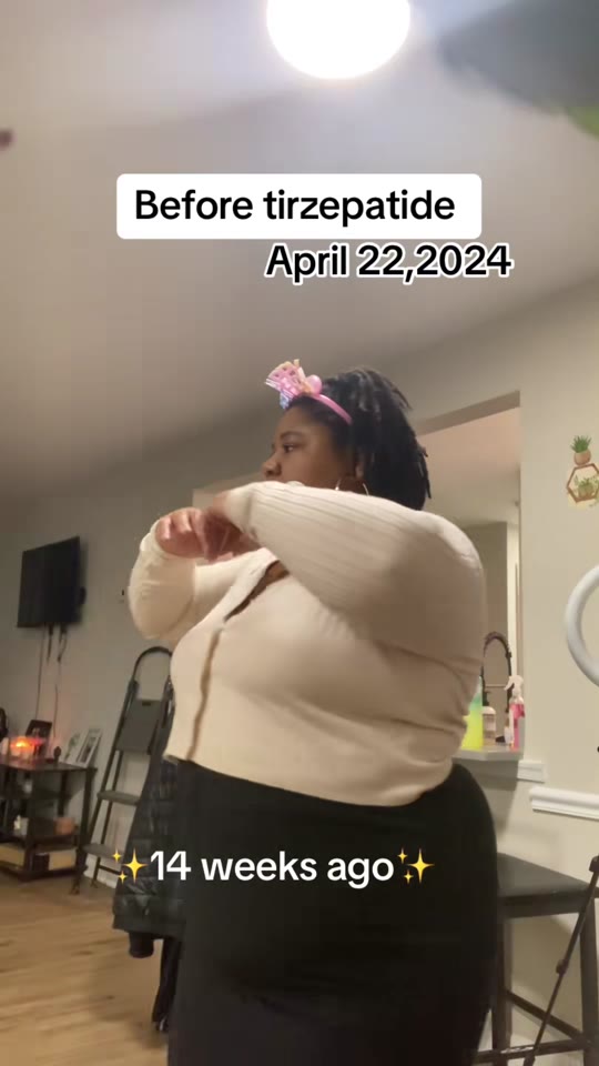 GLP-1 drugs for PCOS weight loss: what TikTok gets right and wrong