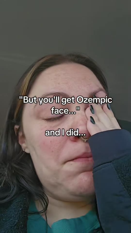 @kaseytwyman's tirzepatide transformation, fact-checked