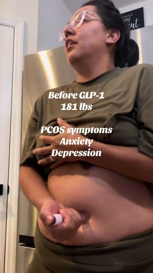 GLP-1s and PCOS: separating real benefits from viral hype