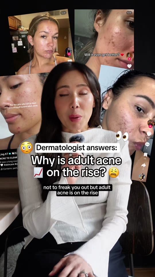 Adult acne, microplastics, and peptides: separating signal from noise