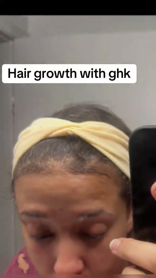 Peptides for hair growth: separating signal from grey market hype