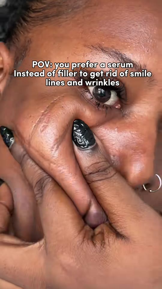 Can Matrixyl ampoules actually replace facial fillers?