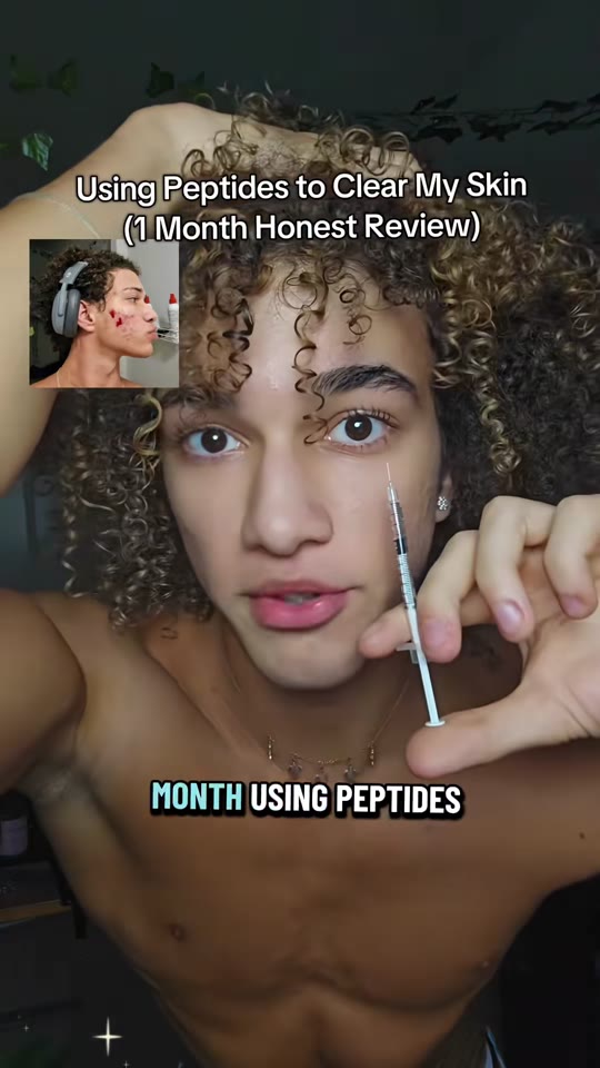 @annnny83's peptide acne scar claims, fact-checked