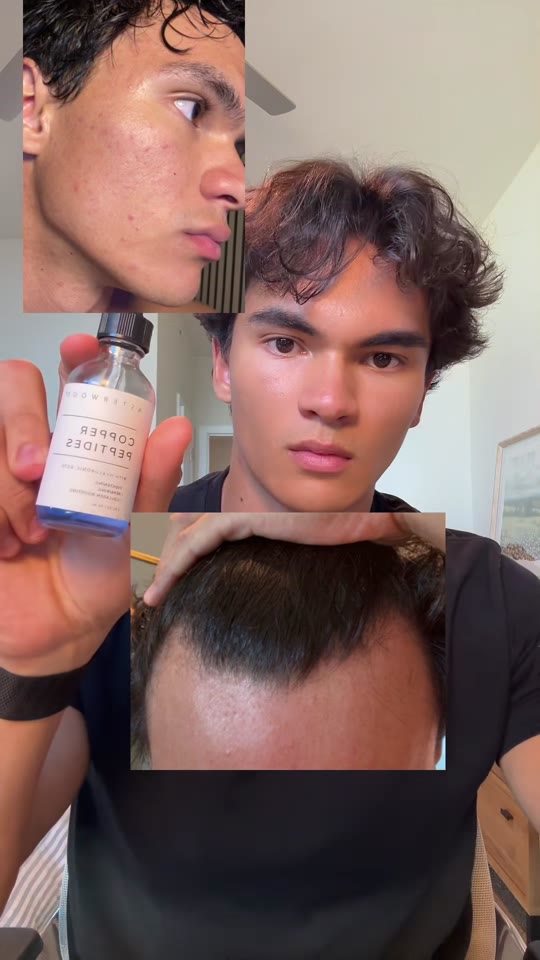 GHK-Cu for glass skin and hair growth: hype vs. evidence