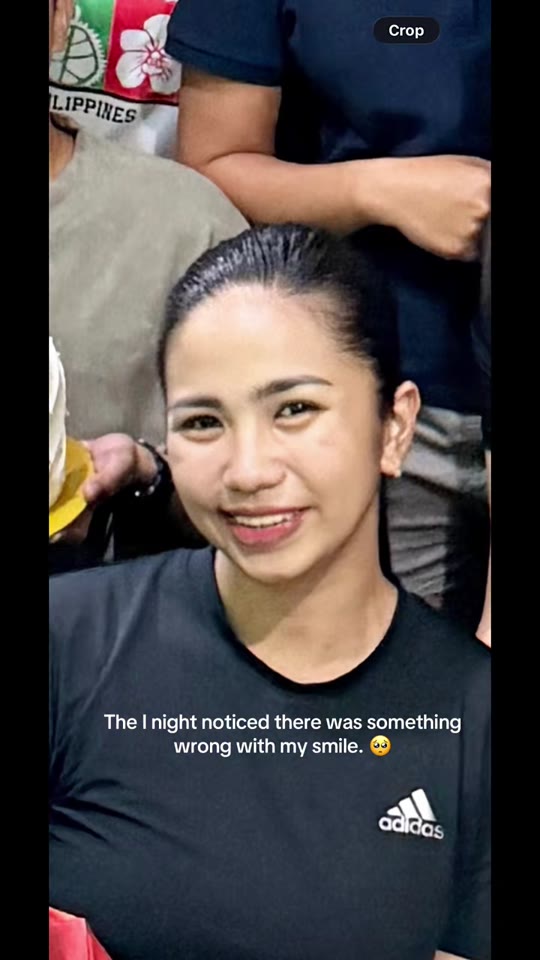 @jadengsss's Bell's palsy claims, fact-checked