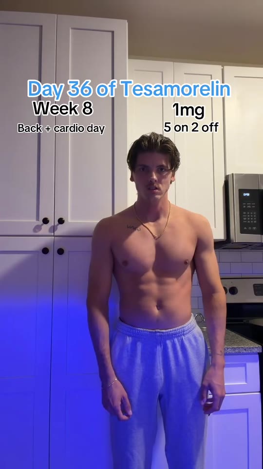Tesamorelin 'day 36' updates: what the science says vs. TikTok
