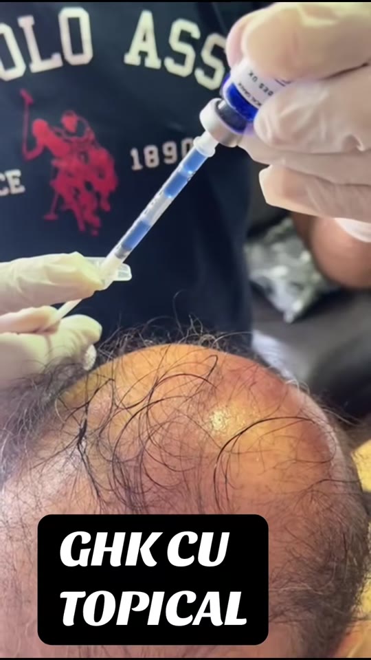 GHK-Cu for hair growth: what the science actually supports