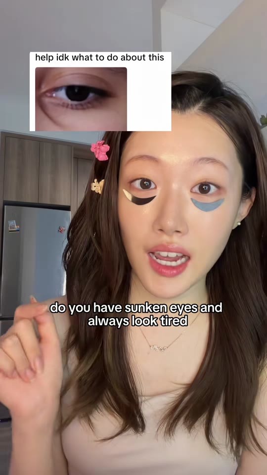 Volufiline for sunken eyes: what the evidence actually shows