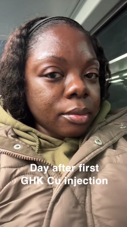 @marielivess's GHK-Cu skincare claims, fact-checked