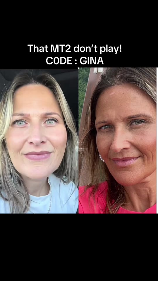Melanotan II for tanning: what TikTok won't tell you about MT2