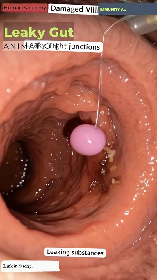Leaky gut syndrome and peptides: separating fact from TikTok fiction