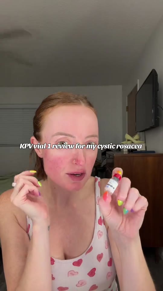 KPV peptide and rosacea: what the science actually supports
