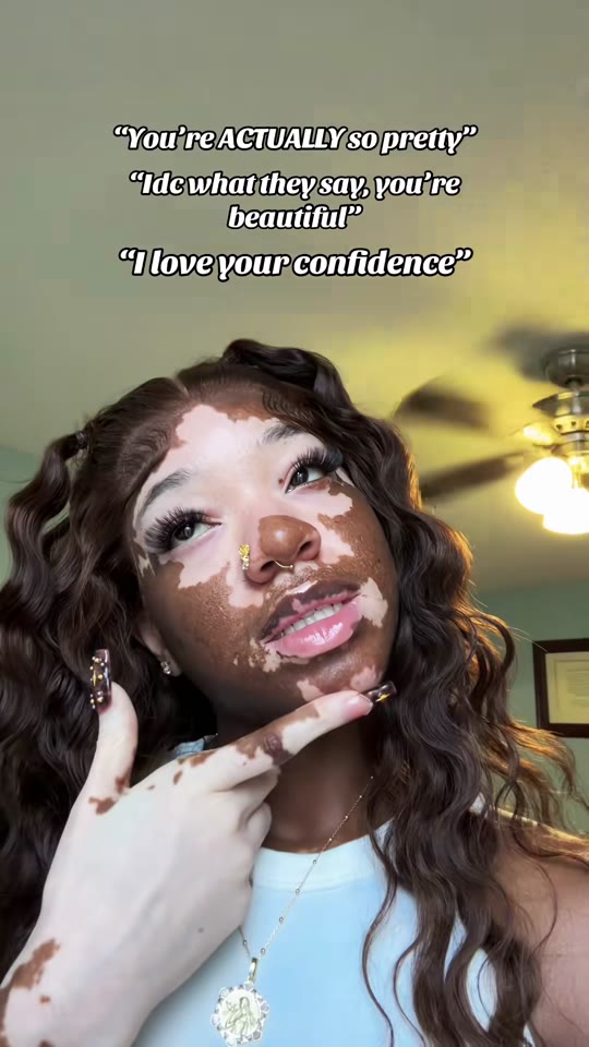 Peptides for vitiligo: separating TikTok hype from the data