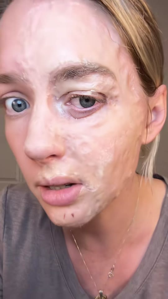 Syn-Ake peptide face masks: smoothing science or overhyped skincare?