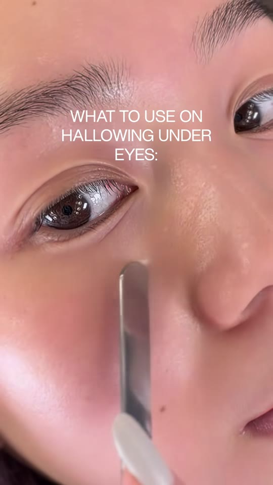 Does Matrixyl 10% actually replace under-eye filler?
