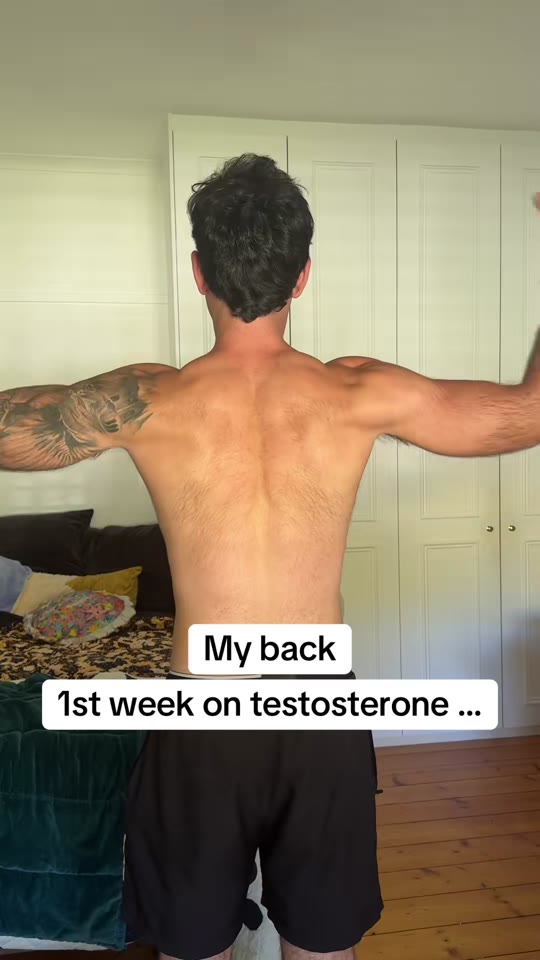 @itslittlelachy's testosterone claims need more context