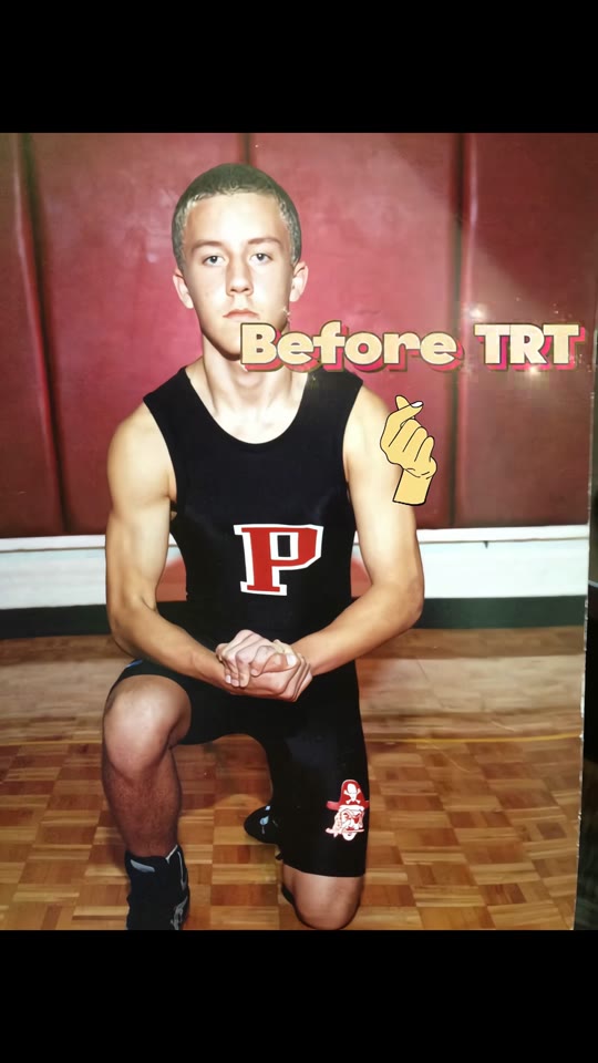 TRT before-and-after claims: what the science actually shows