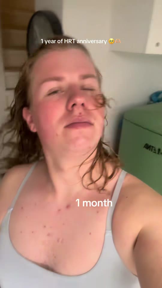 Does feminizing HRT transform quality of life after one year?