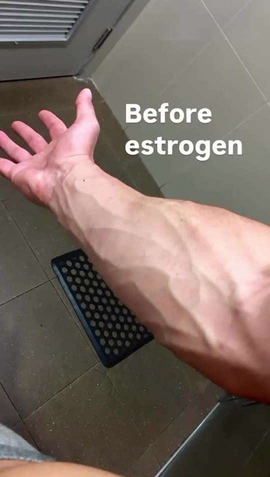 @hrt_estrogen_mtf's body feminization claims, fact-checked