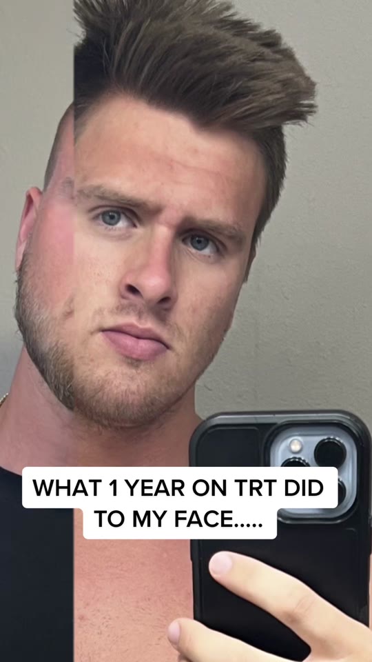 @kmartfit's TRT face transformation claims, fact-checked