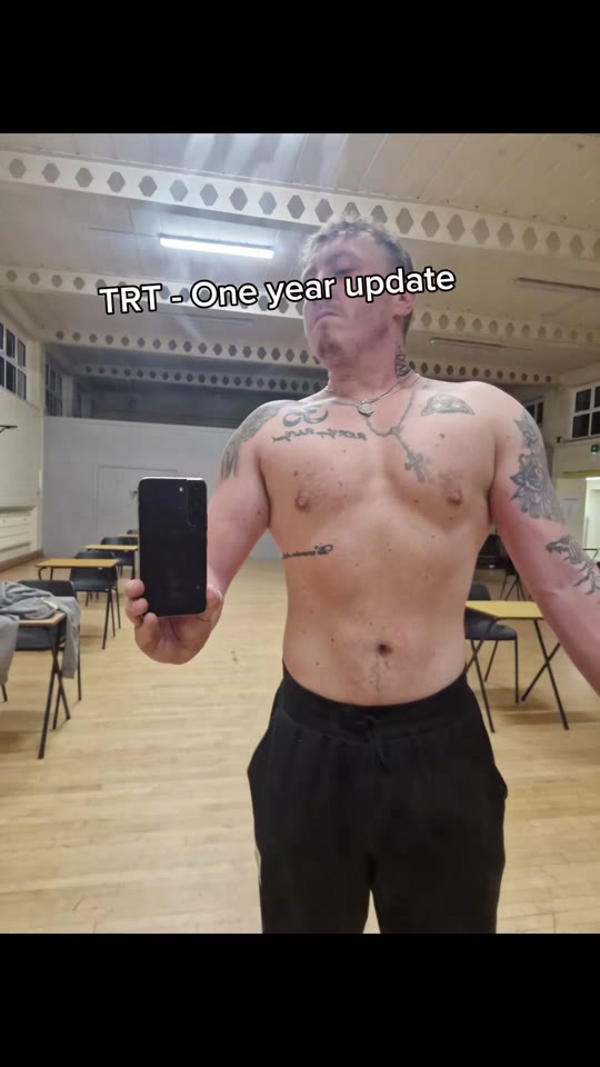 TRT at 28: separating gym progress myths from clinical fact