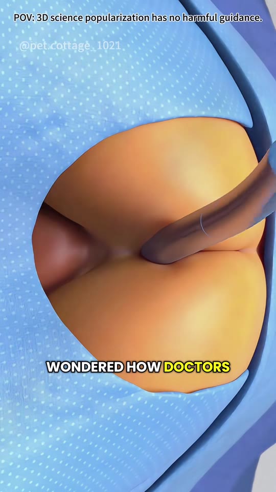 Enema therapy and colon cleansing: what TikTok gets wrong