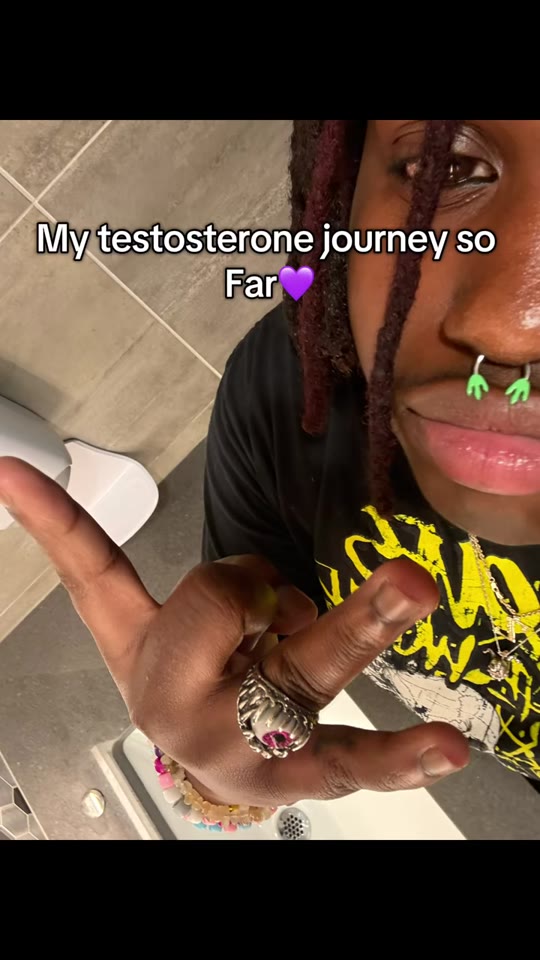 Six months on testosterone: what FTM TikTok gets right and wrong