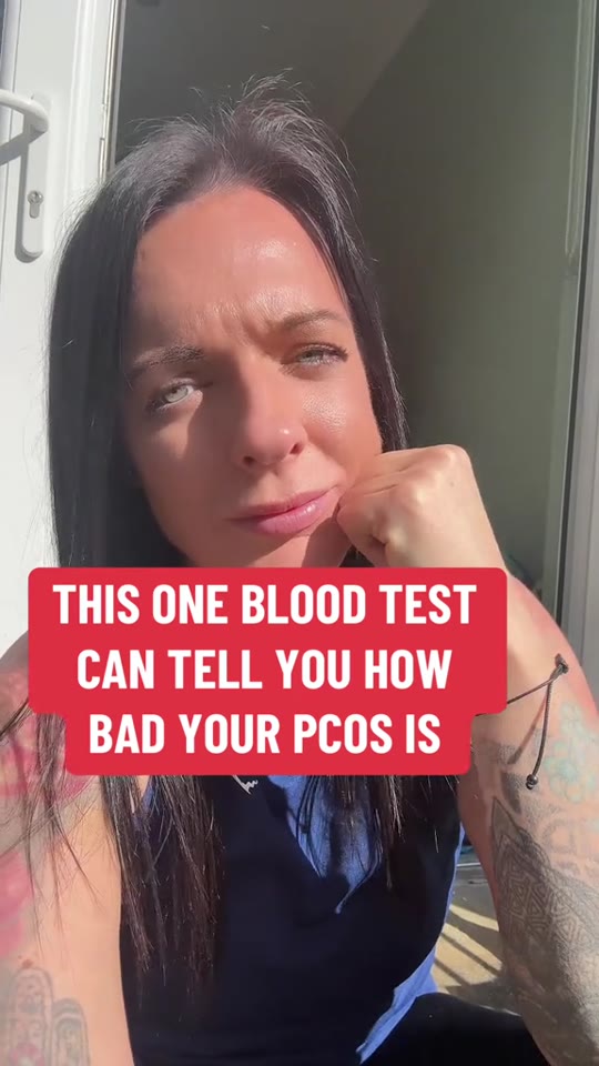 SHBG as a PCOS marker: what the evidence actually supports