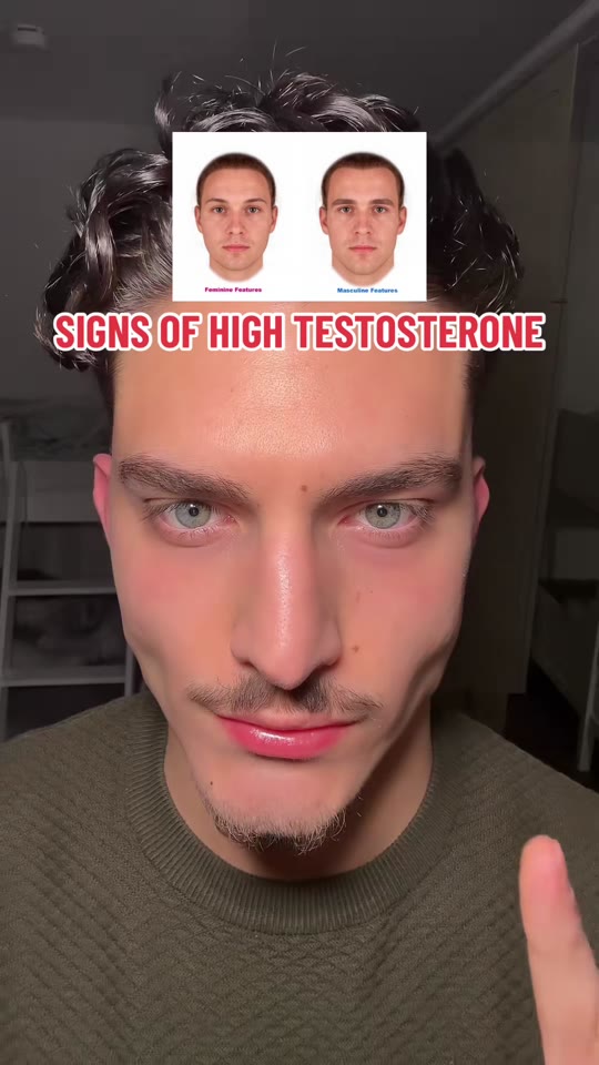 Do 'signs of high testosterone' videos actually reflect real physiology?