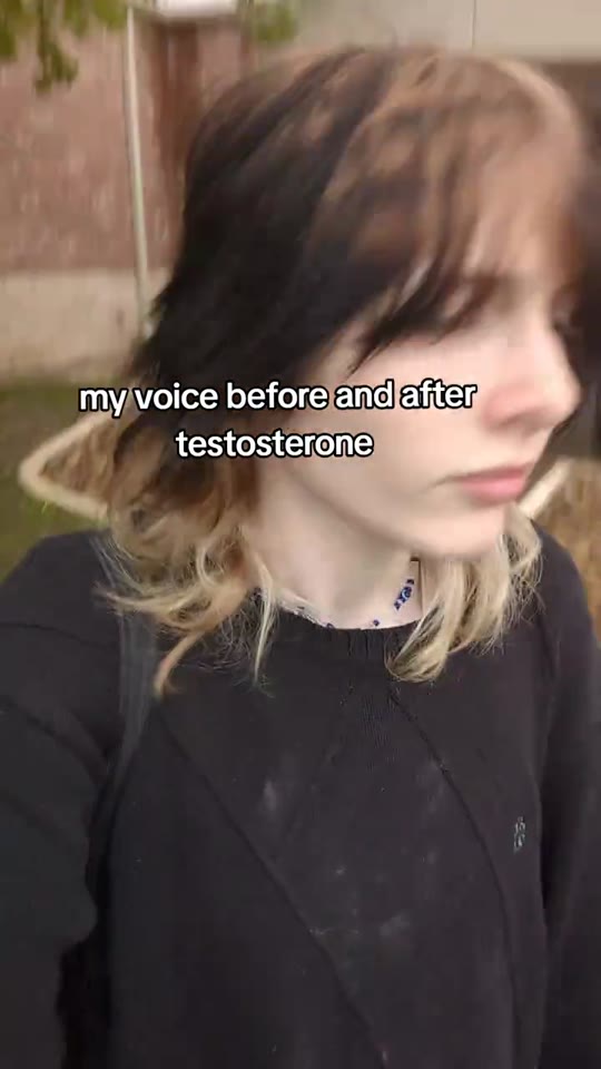 Testosterone and voice changes: what FTM TikTok gets right and wrong